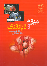 ميوم و ناباروري