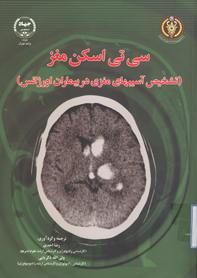 سي تي اسكن مغز