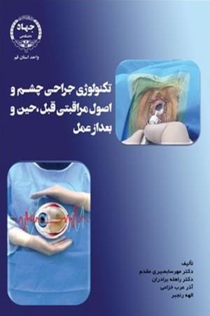 تکنولوژی جراحی چشم و اصول مراقبتی قبل،حین و بعد از عمل 